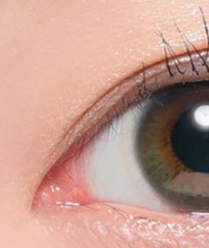 LENS LiST